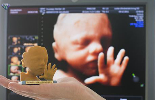 Di-Jepun-Boleh-Cetak-Gambar-Bayi-Yang-Belum-Lahir-Secara-3D
